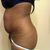 after baby side 1