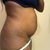 after baby side 2
