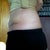 2 weeks and 2 days post.