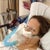 POST OP