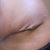 4 Weeks PO.  Ugh.