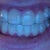 March 14, I will take a better picture when I can, I just wanted a picture to go with my update.