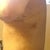 PO Day 11, first thing this morning after my shower, still swollen but getting better....