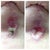Under left breast....Silvadene seems to be working! 
Pic on right was on 1/30, left is on 2/3