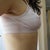 Right breast after explant