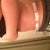 Other side standing hunched over more swelling on this side than the other.