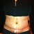 3 Days Post Op