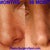 this is not my nose but finding this picture not long after I had my surgery really made me feel a lot better about my results when I was in a slump haha