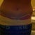 17 days po. Think I look more swollen here than I did at the 6 day po. photo before it.