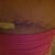 incision on the left hip. 17 days.