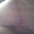 9 Weeks PO L Breast.