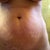 Stomach :(