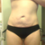 pre-op. Bikini bottom I hope to look good in after tt