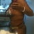 Side (Post-op day 1)