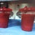 two liters of fat taken from my back with liposuction