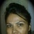 1wk prior to my 3rd Matrix RF Treatment
