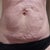 bye bye saggy, dimply skin