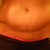4 weeks post op. Is this normal looking???
