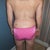 2/6/12 - day of surgery