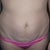2/6/12 - up close of loose skin