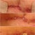Spitting Stitches.  I don't remember when the 1st pic was taken, but you can see it stitch starting to eject.  The last 3 pics are day 45.  I started to mess with it more & after the dried scabby stuff came off you can see the stitches clear as day.