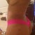 3 Weeks post-op