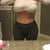 18 DAYS POST OP