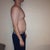 One week before smart lipo. Right side.