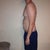 One week before smart lipo. Left side.