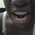 Me teeth