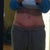6 1/2 weeks with swelling.