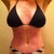 Five Weeks post op tummy tuck