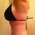 Five Weeks post op tummy tuck