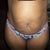 front veiw pre-op