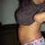 side veiw pre-op