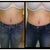 Post Op Day 52 (almost 2 months po)
Left: Guess Jeans Size 29 and very loose!
Right: Bebe Jeans Size 28