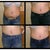 Post Op Day 52 (almost 2 months po)
Left: Guess Jeans size 29 and very loose
Right: Bebe Jeans both size 28