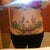 18 days after surgery! do you see a change? I DONT