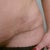 My scar almost 3 wks po
