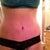 one week post-op!