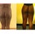 Before and After-5 weeks after surgery