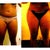 Before and after-5 weeks after surgery