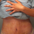 Ignore the horrible spray tan! Two weeks PO Morning