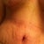 SWELL HELL! Stretch marks aka the ghost of the Pink Marshmallow! 13 days PO