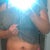 Before tt lipo back and flanks