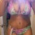 p.o day 10 bikini...still swollen, but im feeling great.