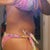 p.o day 10 side view.. still a lil bruised from the lipo but looks better day by day..,.