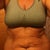 week before surgery