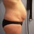 night before tummy tuck