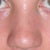 after - I feel like my nose actually looks BIGGER now from the front :/